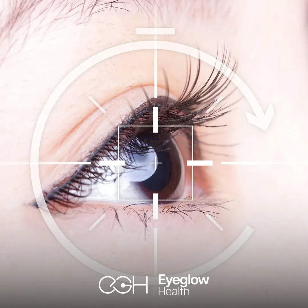 SMILE Pro laser eye surgery at Eyeglow, Istanbul