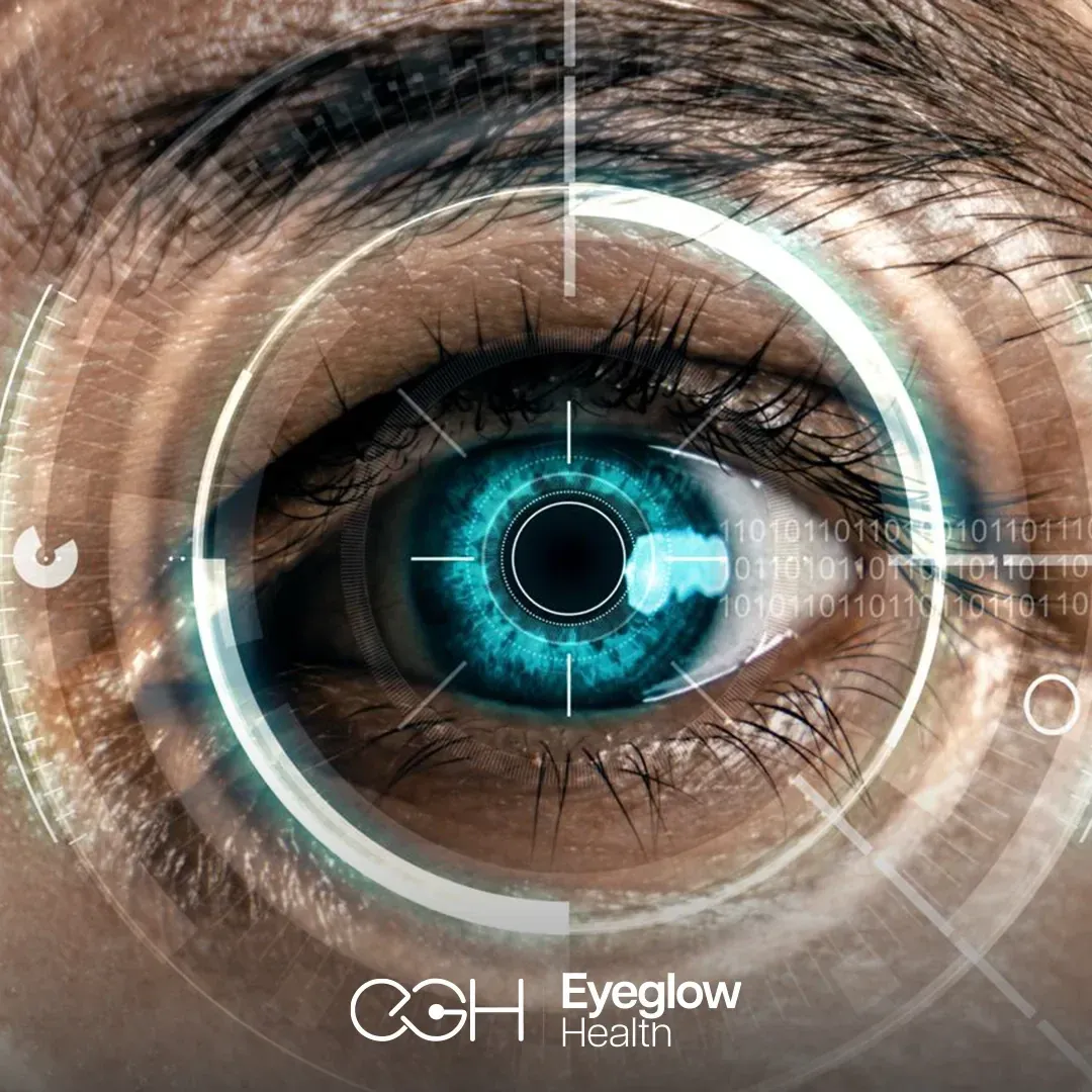 Eye with laser-tracking overlay — Femto-LASIK refractive surgery at Eyeglow Health, Istanbul