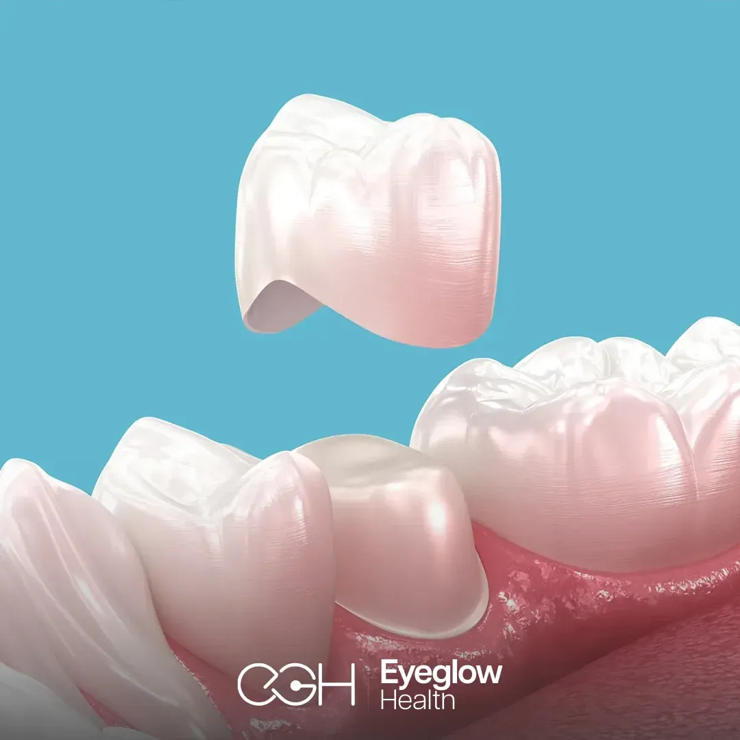 Zirconia crowns at Eyeglow, Istanbul