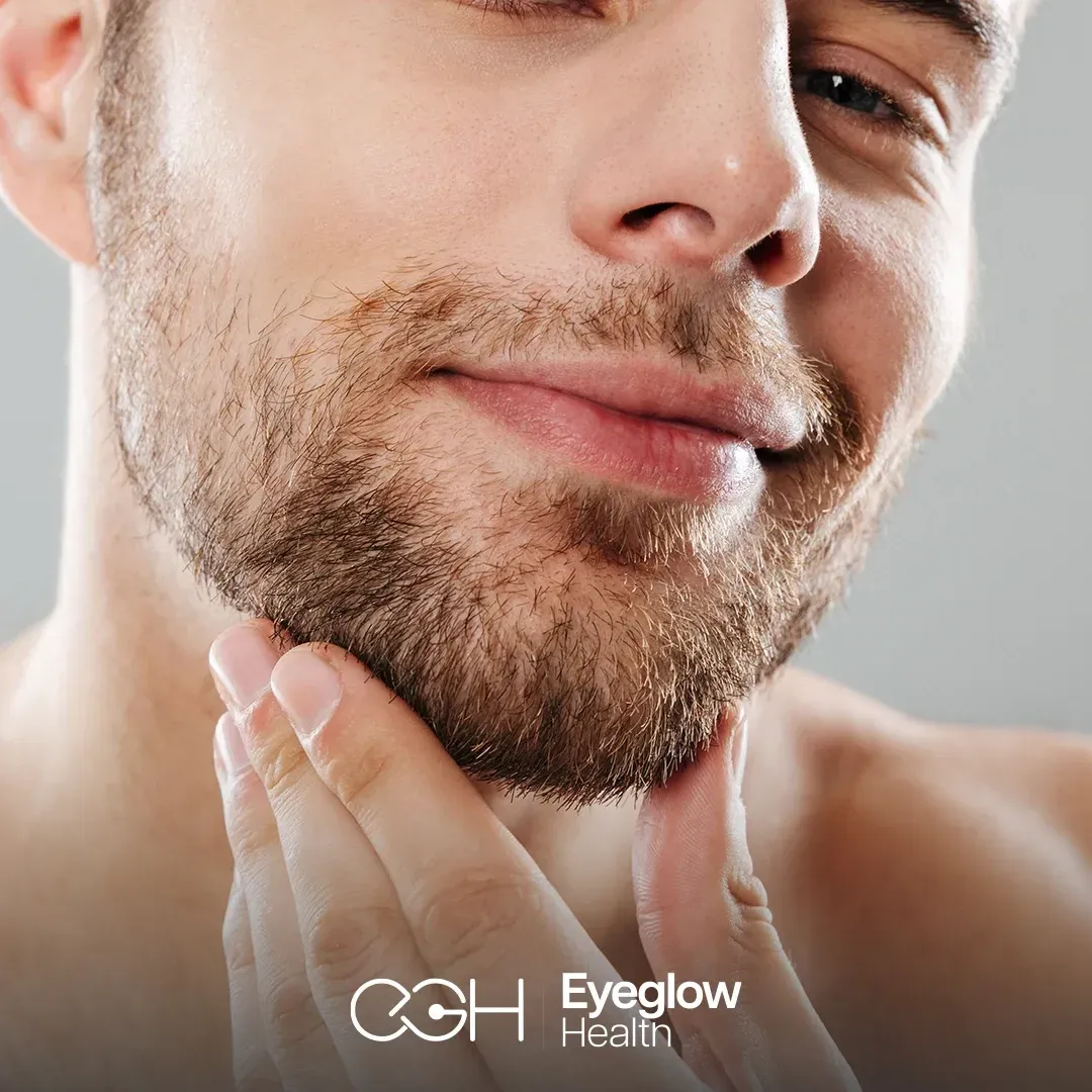 Beard and mustache transplant at Eyeglow, Istanbul