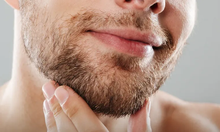 Beard & Mustache Transplant
