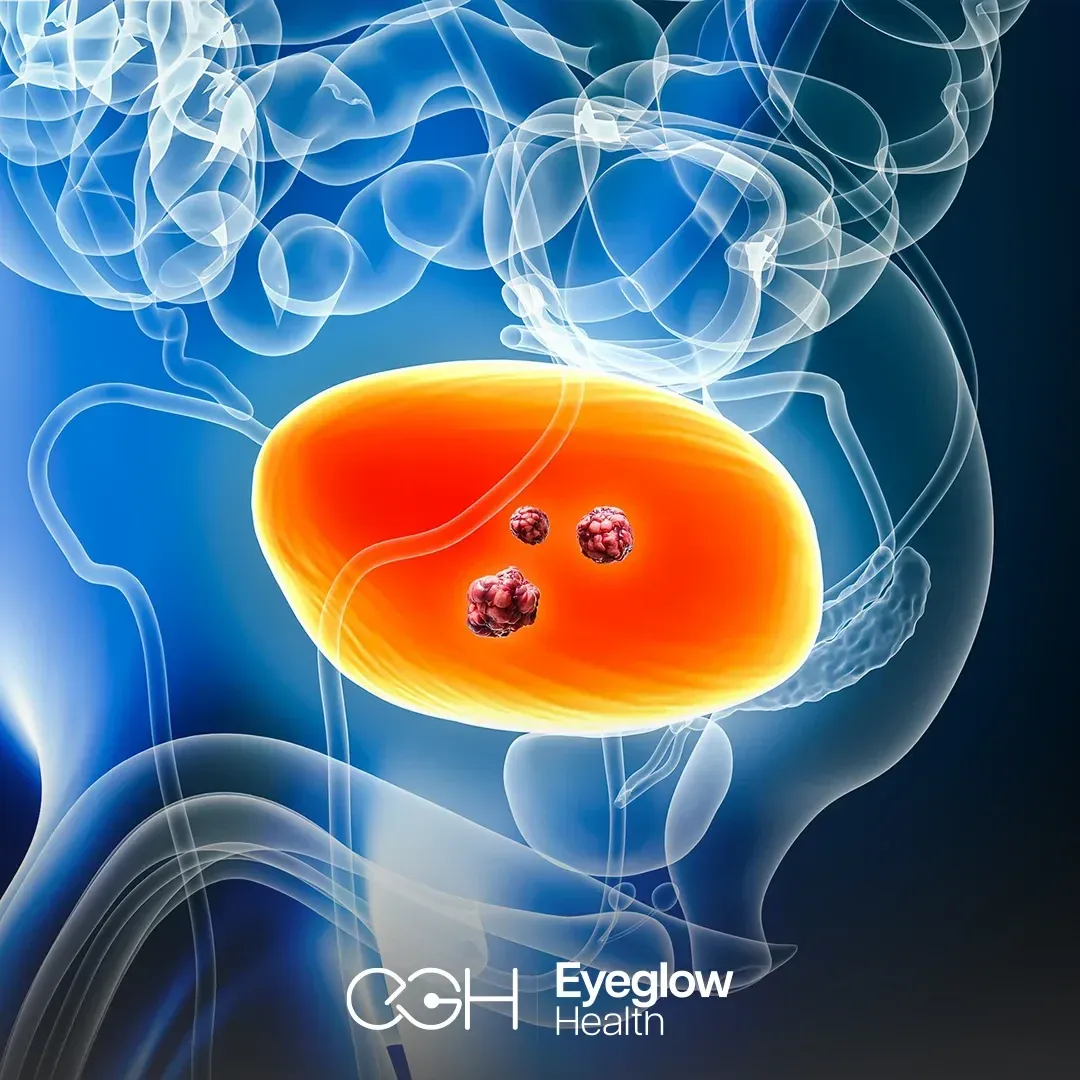 Medical oncology at Eyeglow, Istanbul