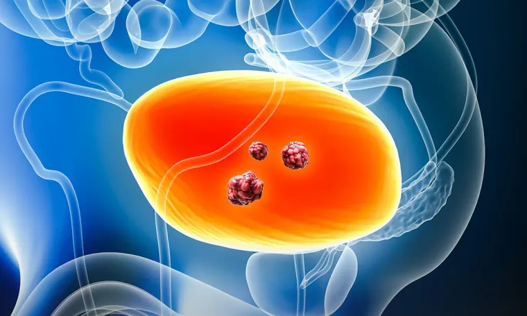 Medical Oncology